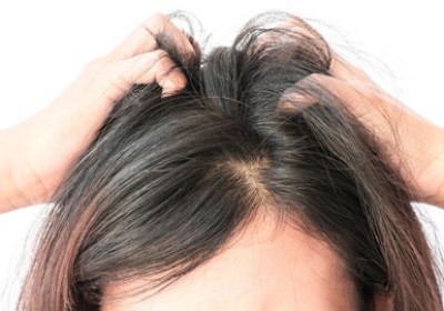 علل ضعیف شدن فولیکول های مو